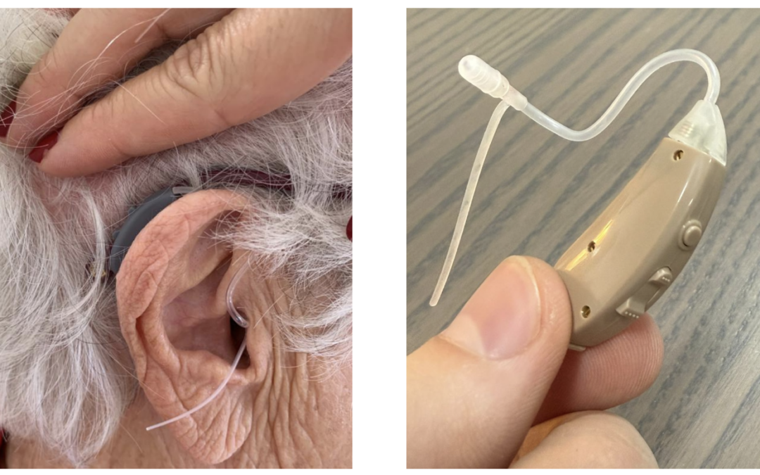 Tout savoir sur les amplificateurs d’écoute : une solution pratique et accessible